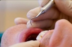 Photo of man at dentist.